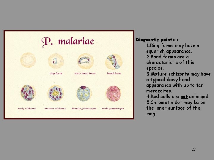  Diagnostic points : - 1. Ring forms may have a squarish appearance. 2.