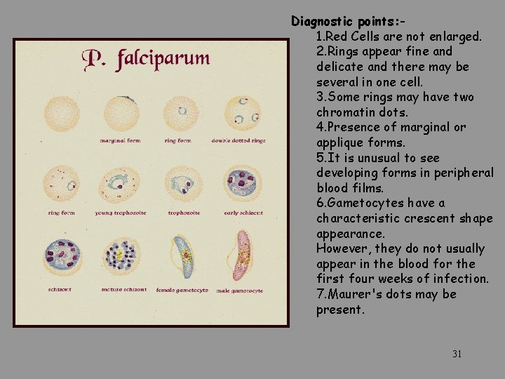 Diagnostic points: 1. Red Cells are not enlarged. 2. Rings appear fine and delicate