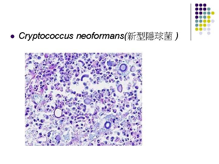 l Cryptococcus neoformans(新型隱球菌 ) 