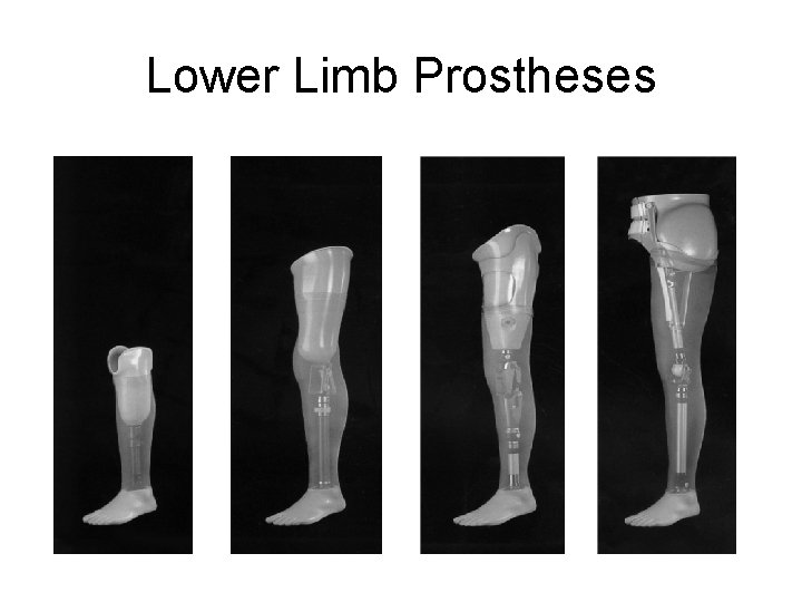Lower Limb Prostheses 