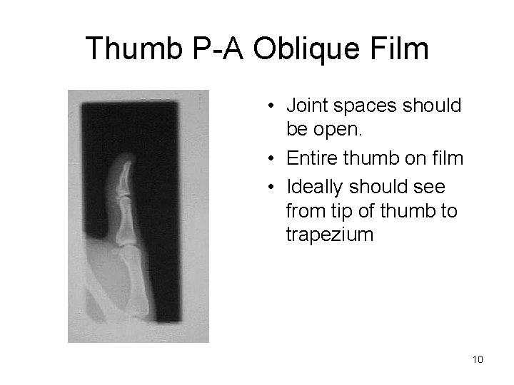 Thumb P-A Oblique Film • Joint spaces should be open. • Entire thumb on