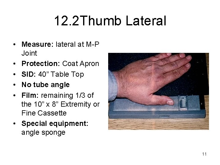 12. 2 Thumb Lateral • Measure: lateral at M-P Joint • Protection: Coat Apron