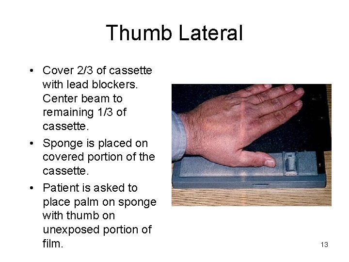 Thumb Lateral • Cover 2/3 of cassette with lead blockers. Center beam to remaining
