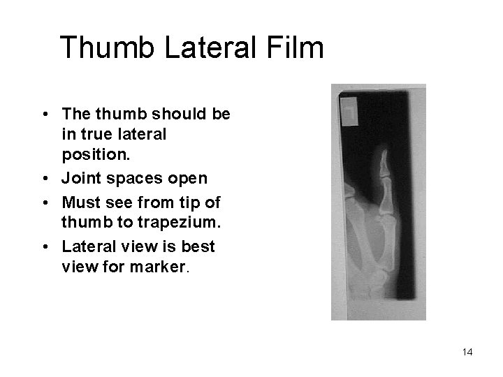 Thumb Lateral Film • The thumb should be in true lateral position. • Joint