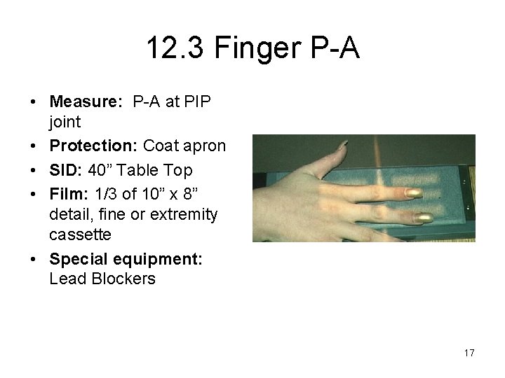 12. 3 Finger P-A • Measure: P-A at PIP joint • Protection: Coat apron