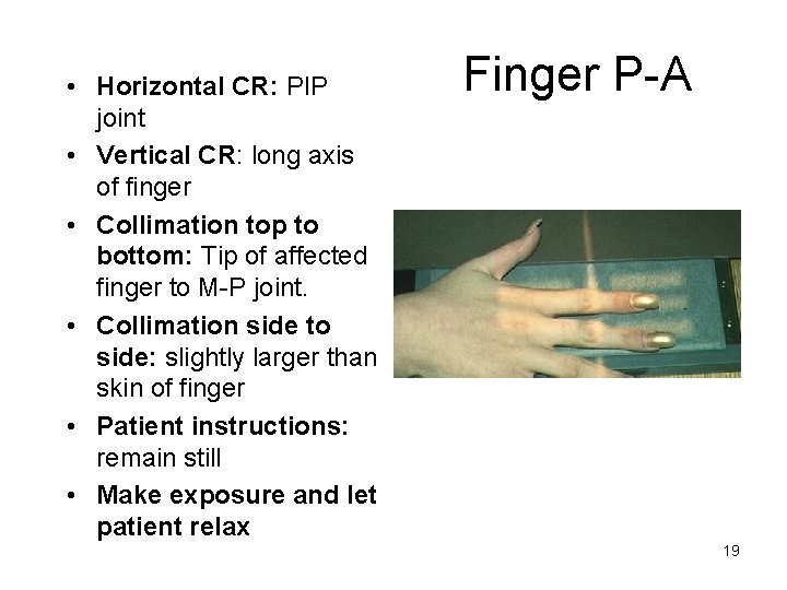  • Horizontal CR: PIP joint • Vertical CR: long axis of finger •