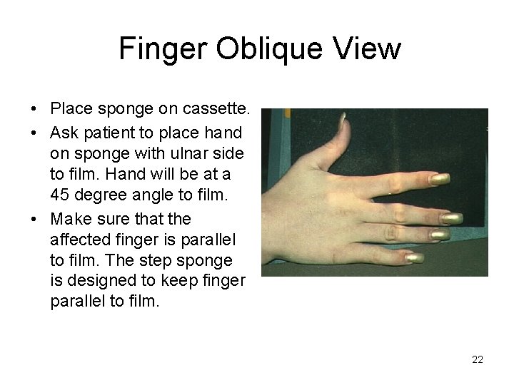 Finger Oblique View • Place sponge on cassette. • Ask patient to place hand