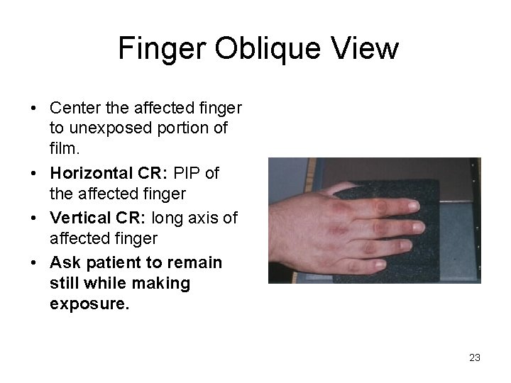 Finger Oblique View • Center the affected finger to unexposed portion of film. •