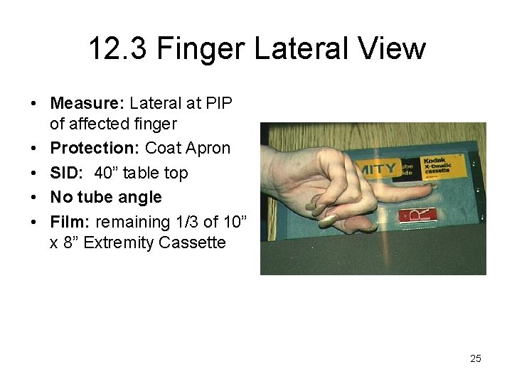 12. 3 Finger Lateral View • Measure: Lateral at PIP of affected finger •