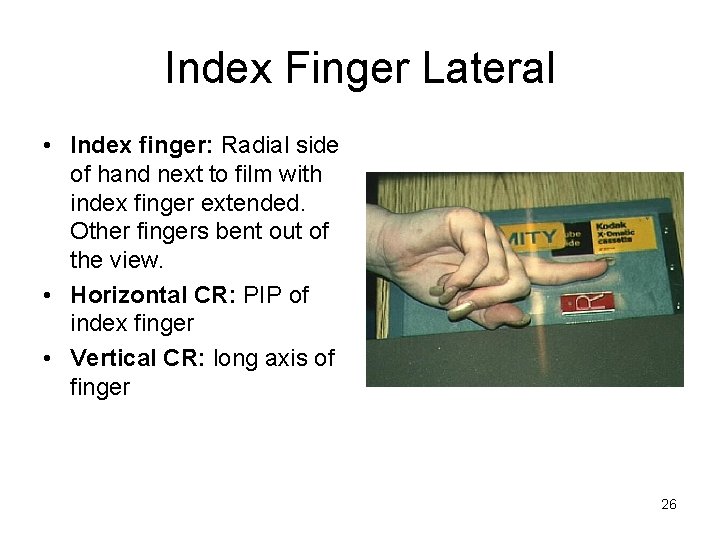 Index Finger Lateral • Index finger: Radial side of hand next to film with