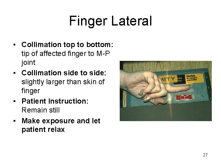 Finger Lateral • Collimation top to bottom: tip of affected finger to M-P joint