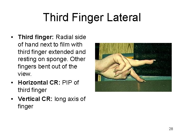 Third Finger Lateral • Third finger: Radial side of hand next to film with
