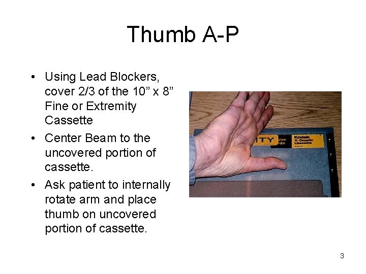 Thumb A-P • Using Lead Blockers, cover 2/3 of the 10” x 8” Fine