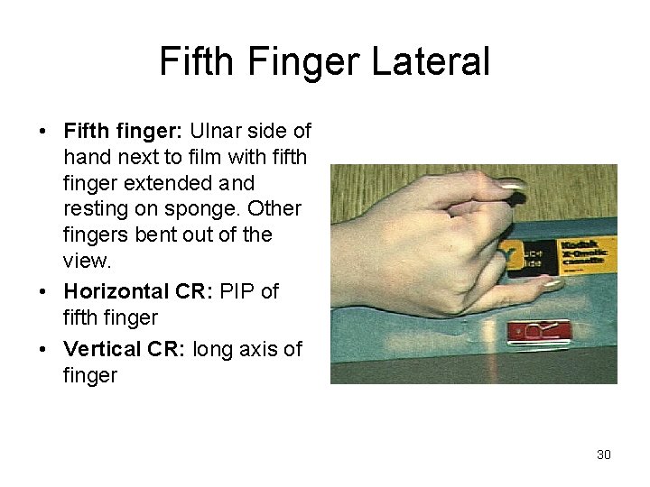 Fifth Finger Lateral • Fifth finger: Ulnar side of hand next to film with