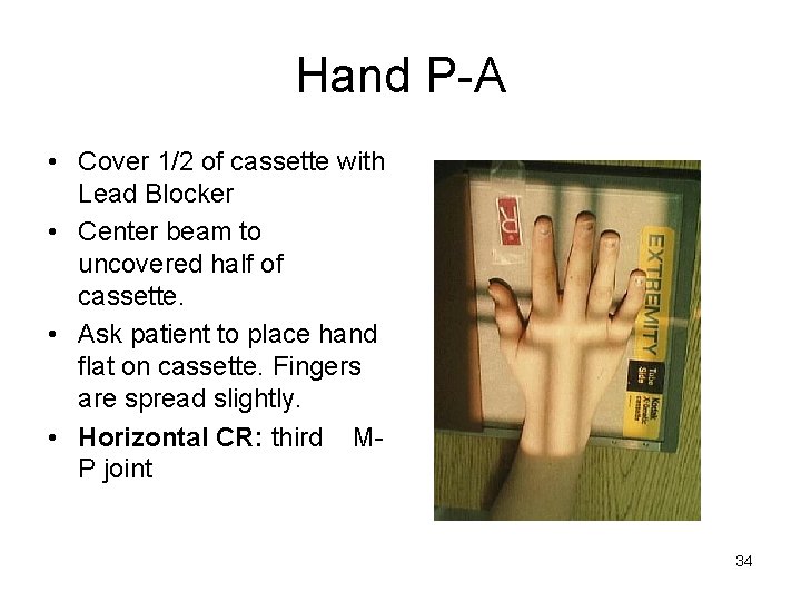 Hand P-A • Cover 1/2 of cassette with Lead Blocker • Center beam to