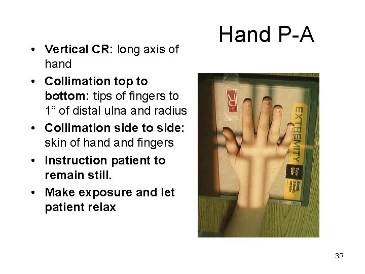  • Vertical CR: long axis of hand • Collimation top to bottom: tips