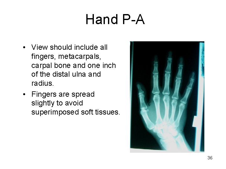 Hand P-A • View should include all fingers, metacarpals, carpal bone and one inch