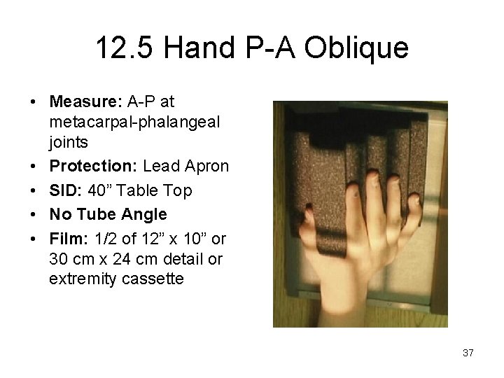 12. 5 Hand P-A Oblique • Measure: A-P at metacarpal-phalangeal joints • Protection: Lead