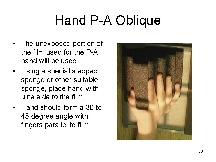 Hand P-A Oblique • The unexposed portion of the film used for the P-A
