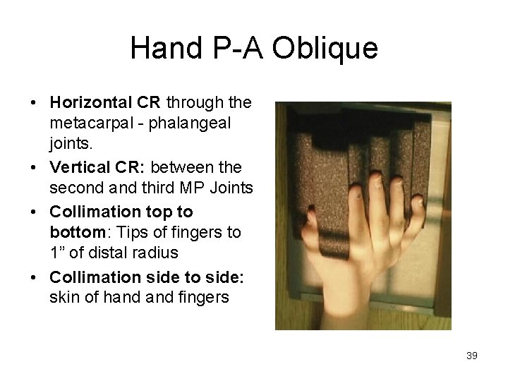 Hand P-A Oblique • Horizontal CR through the metacarpal - phalangeal joints. • Vertical
