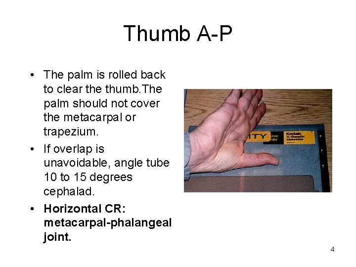 Thumb A-P • The palm is rolled back to clear the thumb. The palm