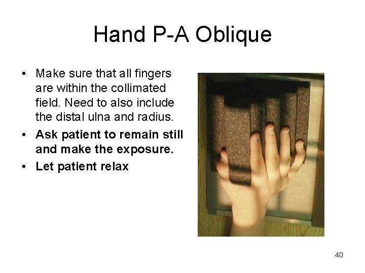 Hand P-A Oblique • Make sure that all fingers are within the collimated field.
