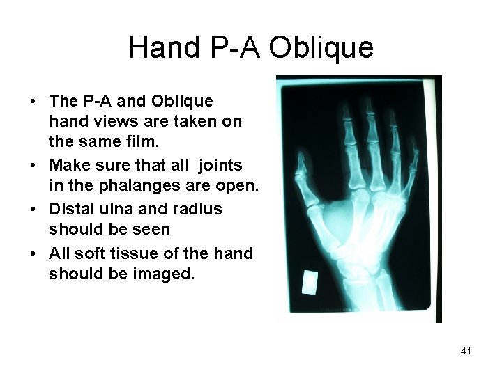 Hand P-A Oblique • The P-A and Oblique hand views are taken on the