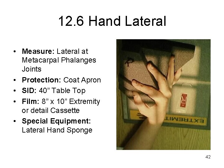 12. 6 Hand Lateral • Measure: Lateral at Metacarpal Phalanges Joints • Protection: Coat