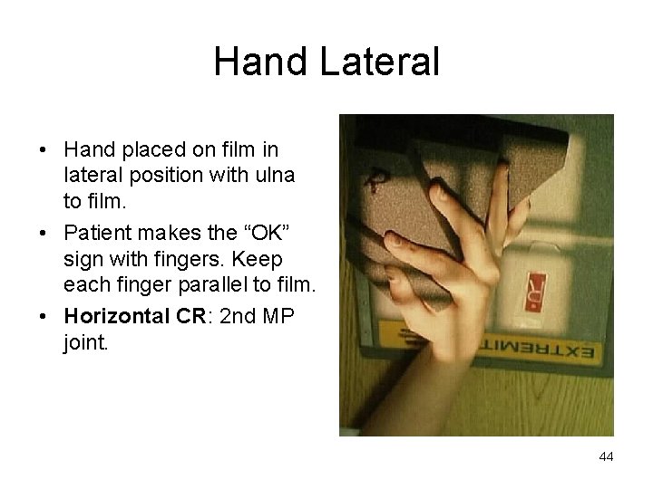 Hand Lateral • Hand placed on film in lateral position with ulna to film.