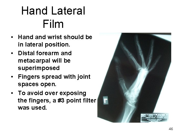 Hand Lateral Film • Hand wrist should be in lateral position. • Distal forearm