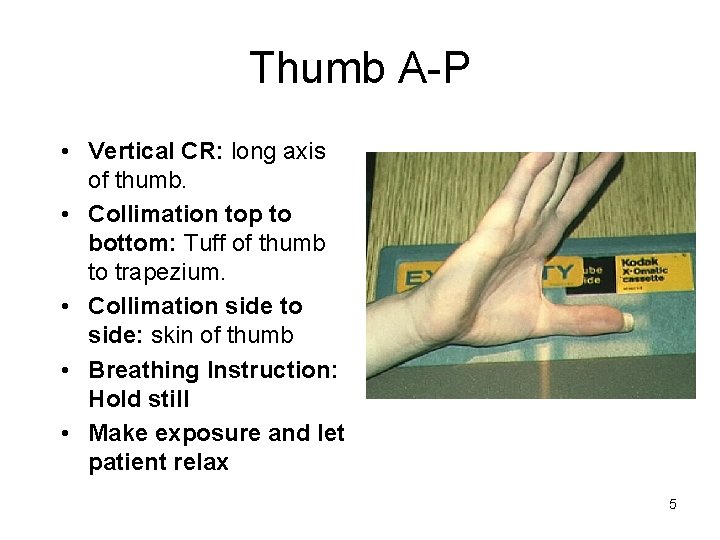 Thumb A-P • Vertical CR: long axis of thumb. • Collimation top to bottom: