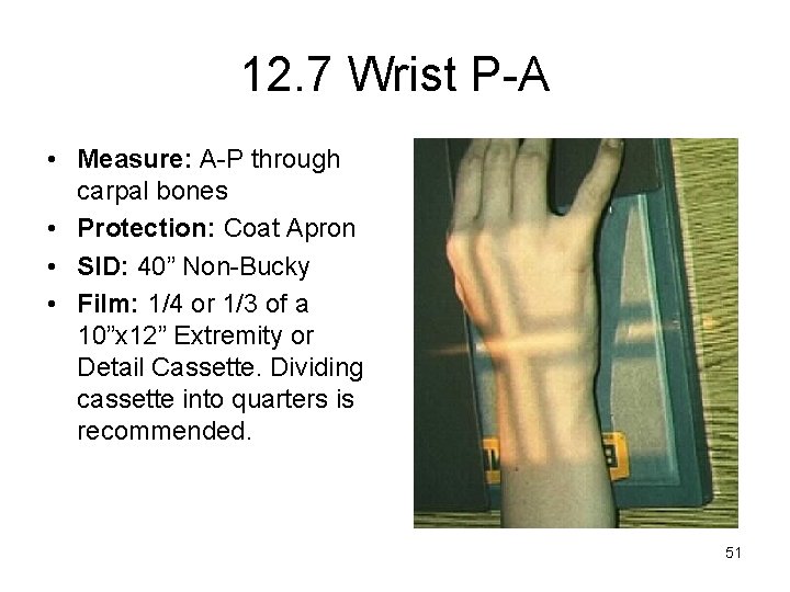 12. 7 Wrist P-A • Measure: A-P through carpal bones • Protection: Coat Apron