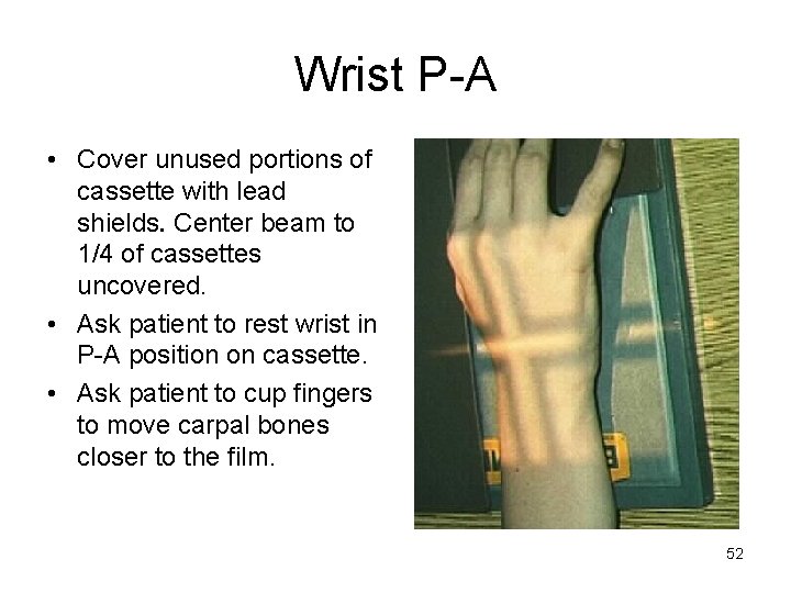 Wrist P-A • Cover unused portions of cassette with lead shields. Center beam to