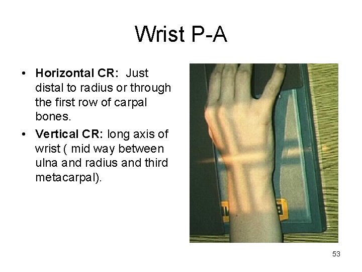Wrist P-A • Horizontal CR: Just distal to radius or through the first row