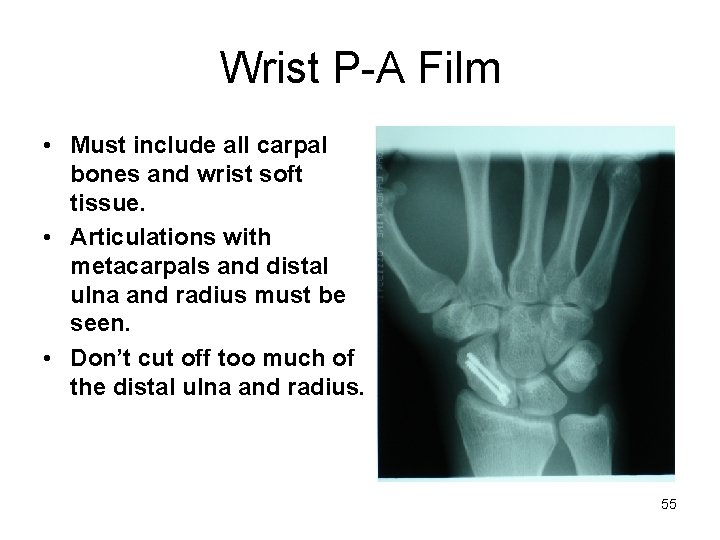 Wrist P-A Film • Must include all carpal bones and wrist soft tissue. •