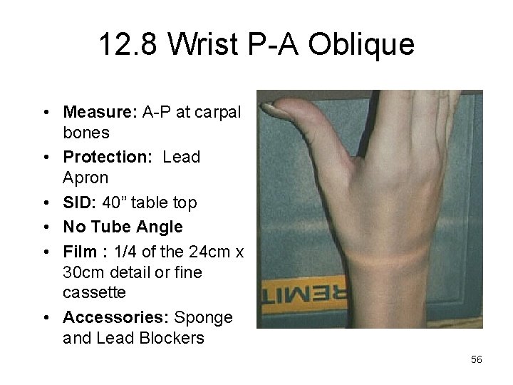 12. 8 Wrist P-A Oblique • Measure: A-P at carpal bones • Protection: Lead