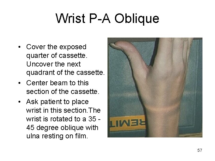 Wrist P-A Oblique • Cover the exposed quarter of cassette. Uncover the next quadrant