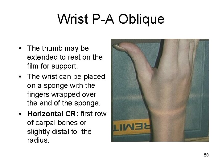 Wrist P-A Oblique • The thumb may be extended to rest on the film