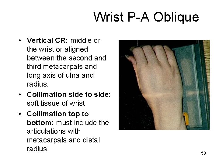 Wrist P-A Oblique • Vertical CR: middle or the wrist or aligned between the
