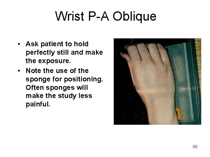 Wrist P-A Oblique • Ask patient to hold perfectly still and make the exposure.