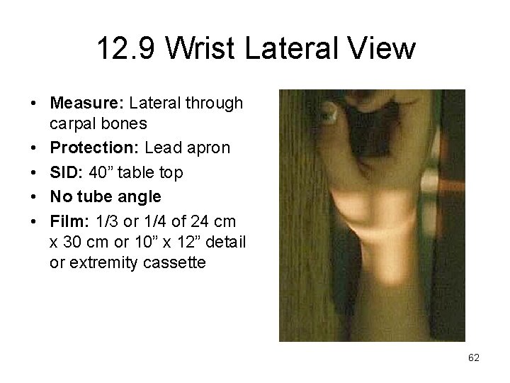 12. 9 Wrist Lateral View • Measure: Lateral through carpal bones • Protection: Lead