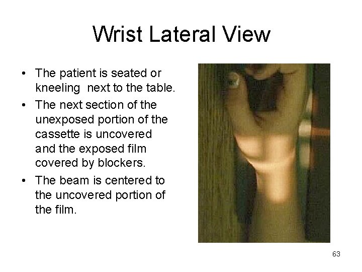 Wrist Lateral View • The patient is seated or kneeling next to the table.