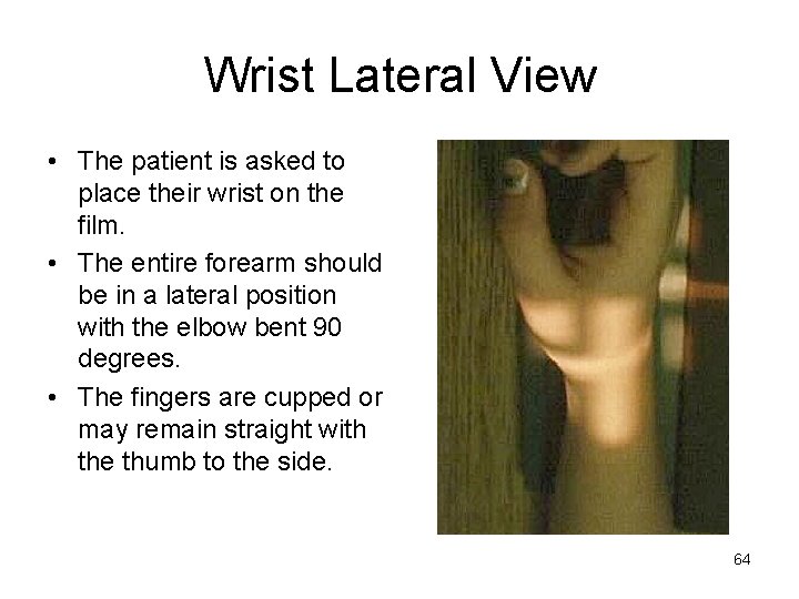 Wrist Lateral View • The patient is asked to place their wrist on the