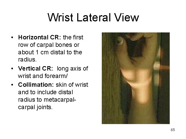 Wrist Lateral View • Horizontal CR: the first row of carpal bones or about