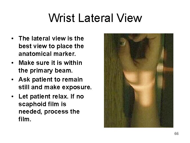 Wrist Lateral View • The lateral view is the best view to place the