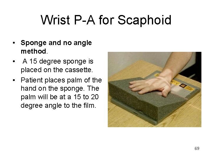 Wrist P-A for Scaphoid • Sponge and no angle method. • A 15 degree