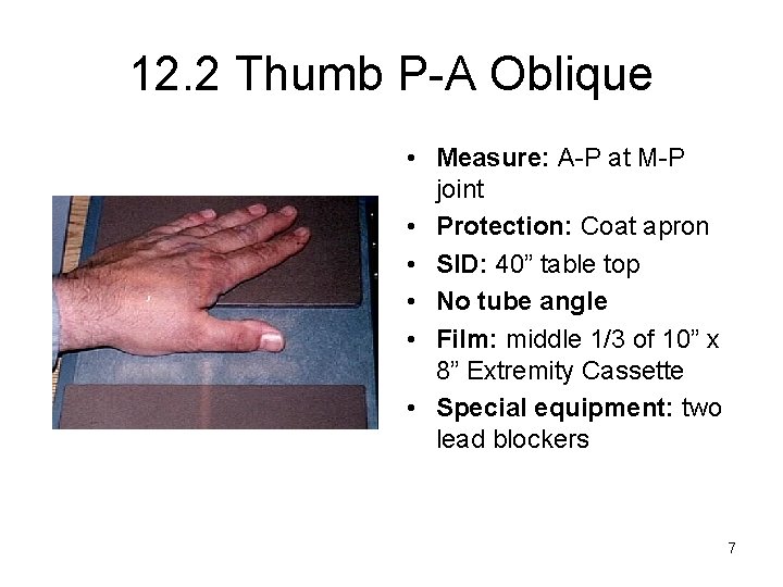12. 2 Thumb P-A Oblique • Measure: A-P at M-P joint • Protection: Coat