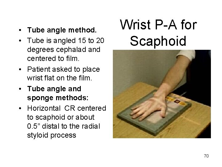  • Tube angle method. • Tube is angled 15 to 20 degrees cephalad