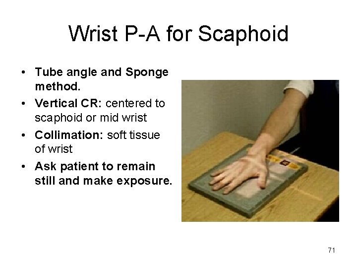 Wrist P-A for Scaphoid • Tube angle and Sponge method. • Vertical CR: centered