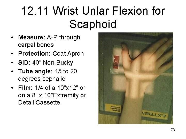 12. 11 Wrist Unlar Flexion for Scaphoid • Measure: A-P through carpal bones •
